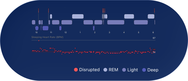 Sleep Pattern Graph