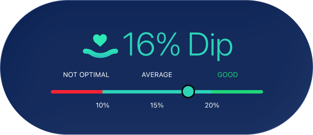 Heart Rate Dip