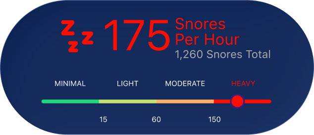 Snore Score