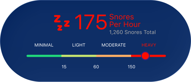 Track Your Snoring Level