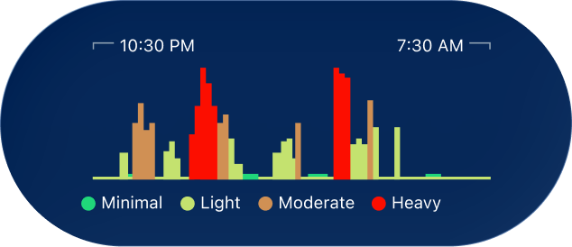 See Your Snore Pattern
